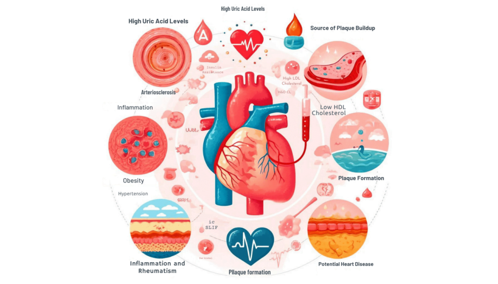 Uric Acid and Cardiovascular Health